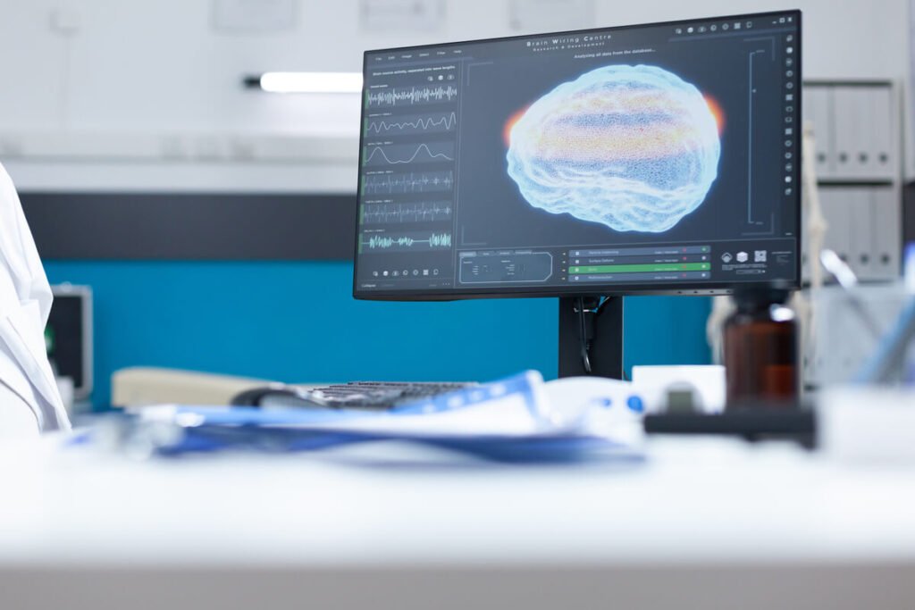 Hypersignaux FLAIR à l'IRM et vertiges : comprendre vos résultats d'examen 2 Une image d'IRM cérébrale sur un écran rétroéclairé montrant les structures du cerveau en séquence FLAIR.