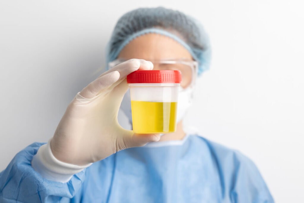Klebsiella pneumoniae dans l’urine : est ce grave ? 2